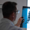 Understanding Your Mesothelioma Diagnosis