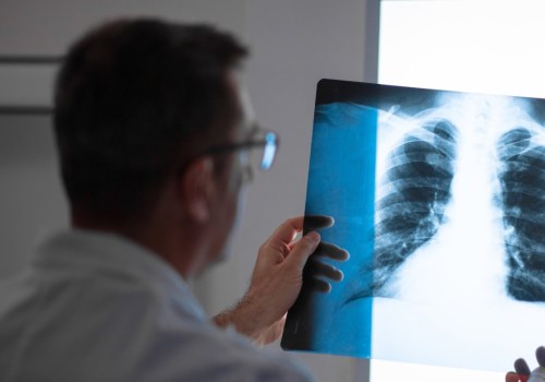 Understanding Your Mesothelioma Diagnosis